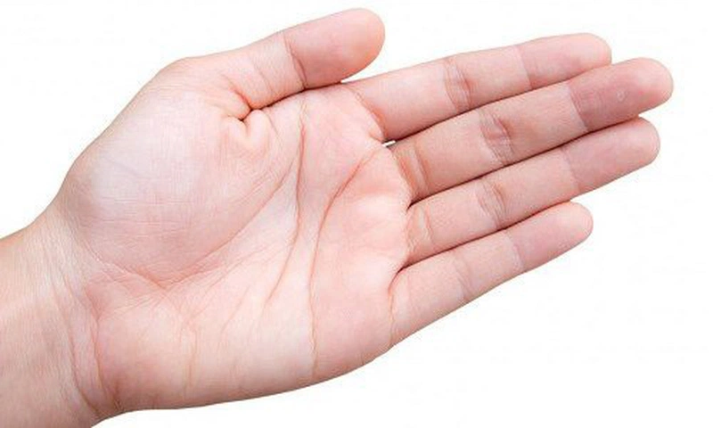 Gen di truyền là một trong những nguyên nhân khiến ngón tay ngắn mập