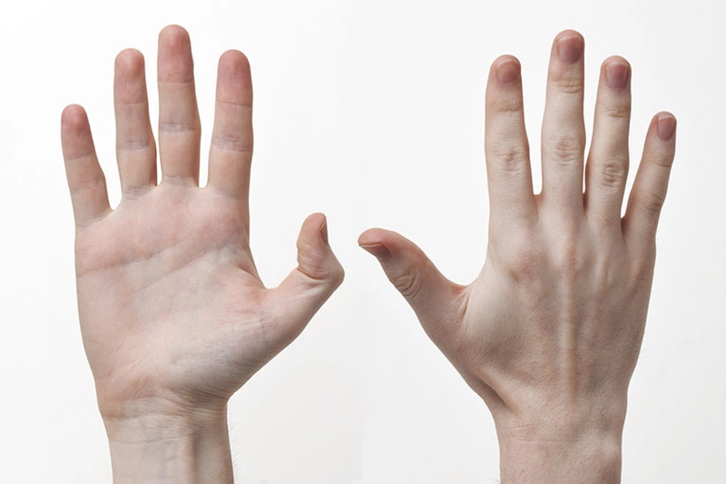 Bài tập duỗi căng các ngón tay là một trong những cách làm ngón tay thon dài