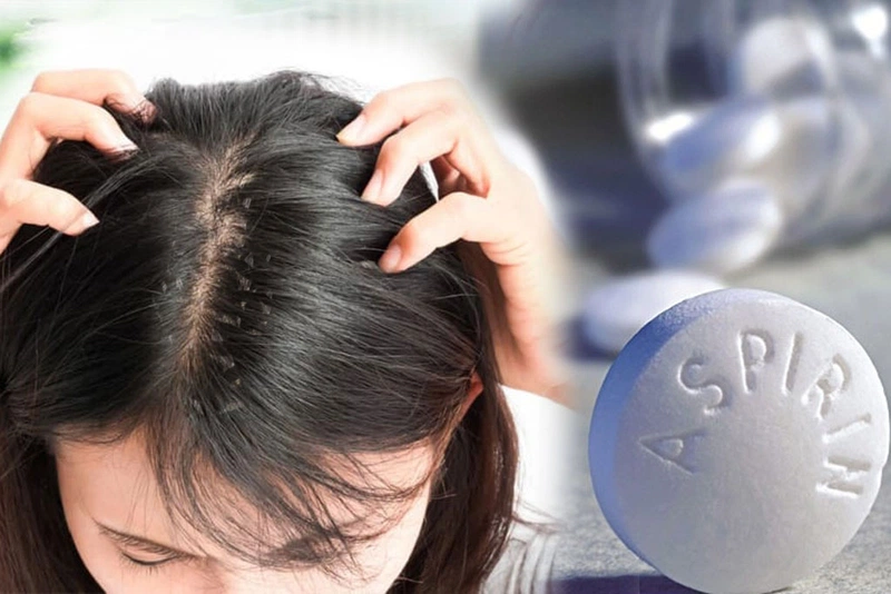 Cách làm tóc sạch gàu với những nguyên liệu khó tin