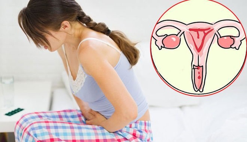 Cách nhận biết bệnh lậu ở nữ giới 2