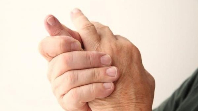 Tình trạng bong gân ngón tay xảy ra khi dây chằng ở ngón tay bị kéo giãn hoặc bị rách, bị đứt