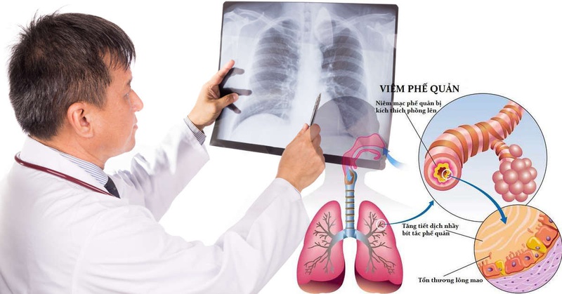Cách phòng bệnh đường hô hấp khi giao mùa - Bạn đã biết chưa? 1