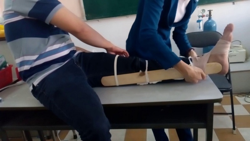 Cách sơ cứu gãy xương kín như thế nào? 3