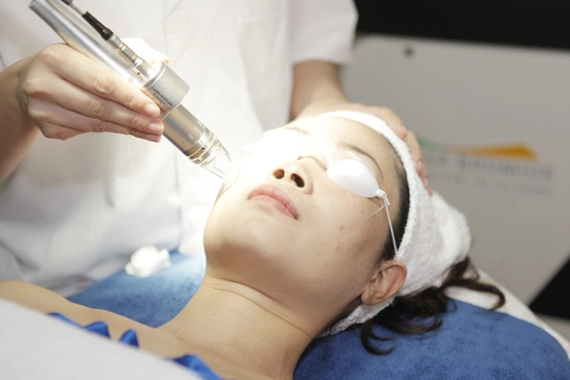 Cách trị th-m sau khi bắn laser bạn đã biết chưa?