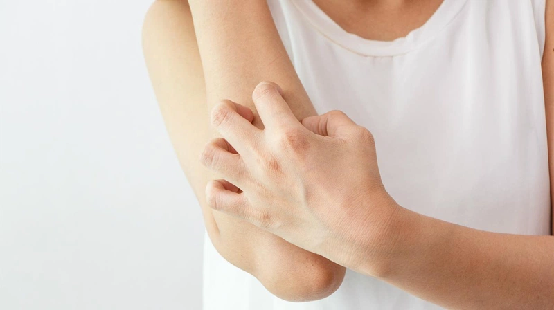 Cách trị viêm nang lông bằng lá trầu không1