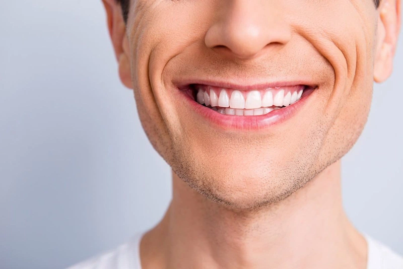 Cách xóa rãnh cười tại nhà hiệu quả 1