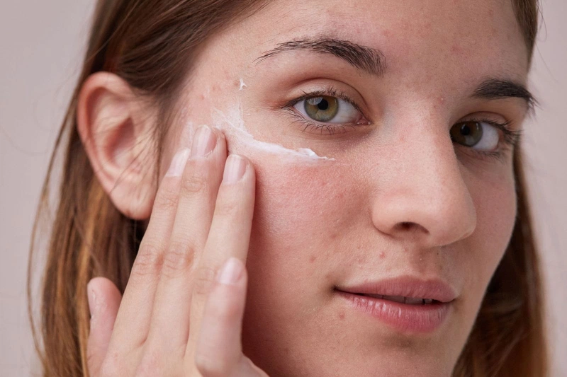 Cách xử lý dị ứng mỹ phẩm mụn mủ và lưu ý điều trị lâu dài 1