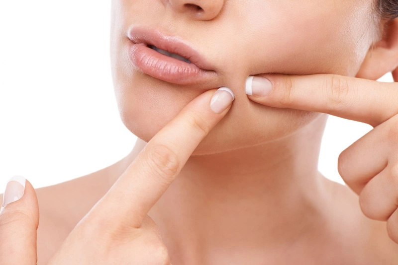 Cách xử lý dị ứng mỹ phẩm mụn mủ và lưu ý điều trị lâu dài 2