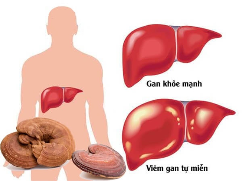 nam-linh-chi-chua-benh-gi-cong-dung-that-su-cua-nam-linh-chi-1