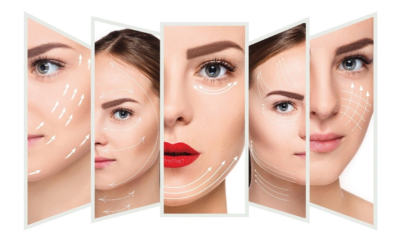 Căng da mặt bằng chỉ là một trong những cách trẻ hóa làn da an toàn