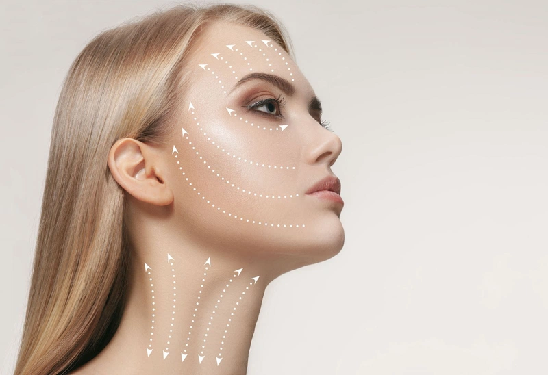 Căng chỉ collagen giúp bạn nhìn trẻ hơn từ 5-10 tuổi