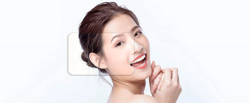 Căng chỉ collagen là gì?