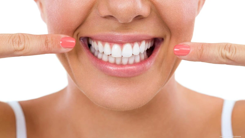 Căng chỉ rãnh cười có tác dụng thật sự không? 1