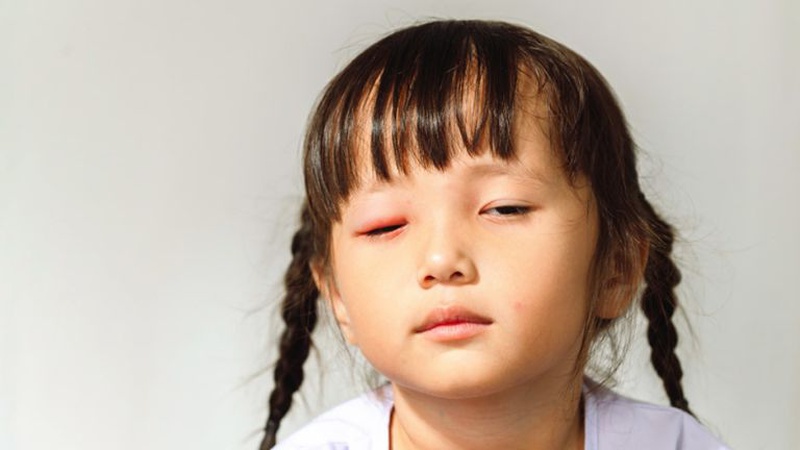 Dấu hiệu nhận biết ung thư mắt ở trẻ em