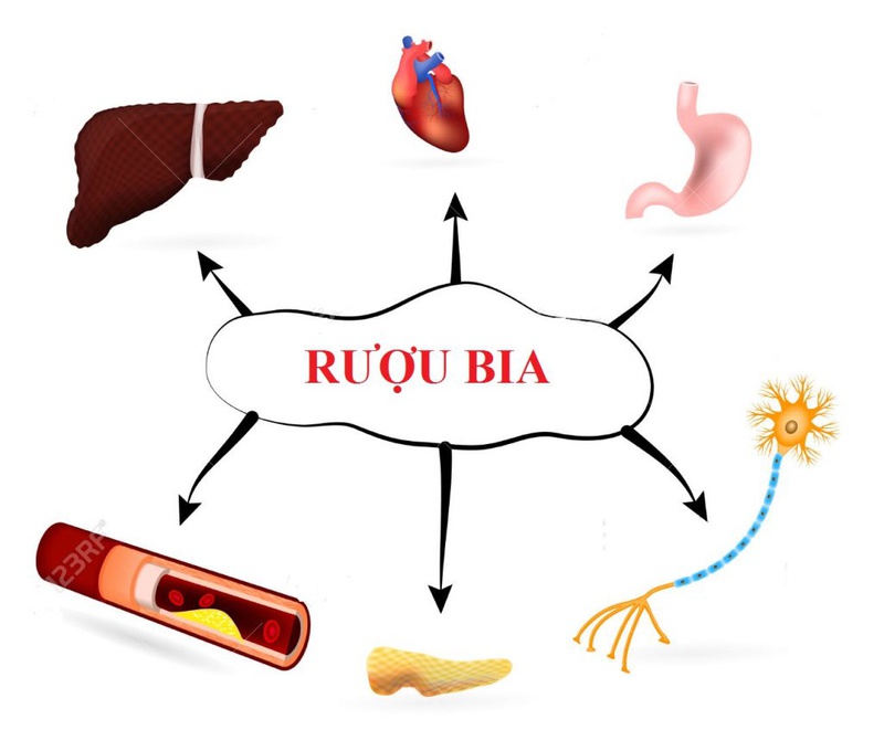 Cảnh giác với bia rượu và các bệnh dị ứng tiềm ẩn nguy cơ gây hại cho sức khỏe 2
