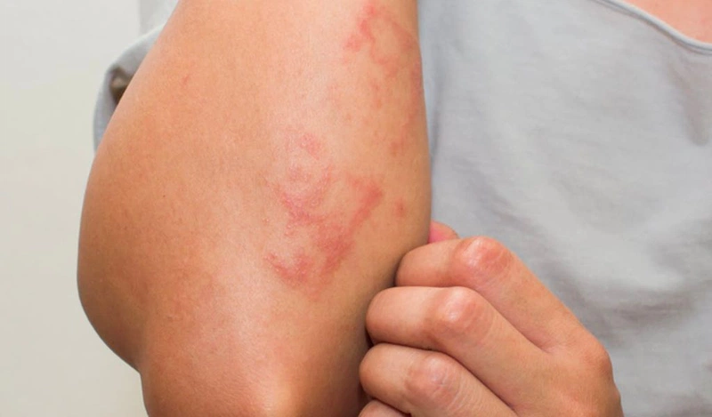 Cây đuôi chuột giúp điều trị bệnh hiệu quả như thế nào? 3