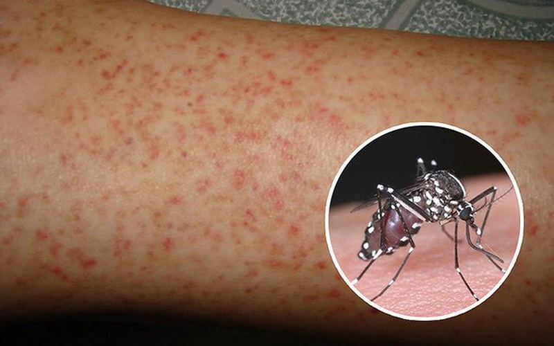 Cây huyết dụ xanh dùng để chữa nhiều loại bệnh máu trong đó có sốt xuất huyết