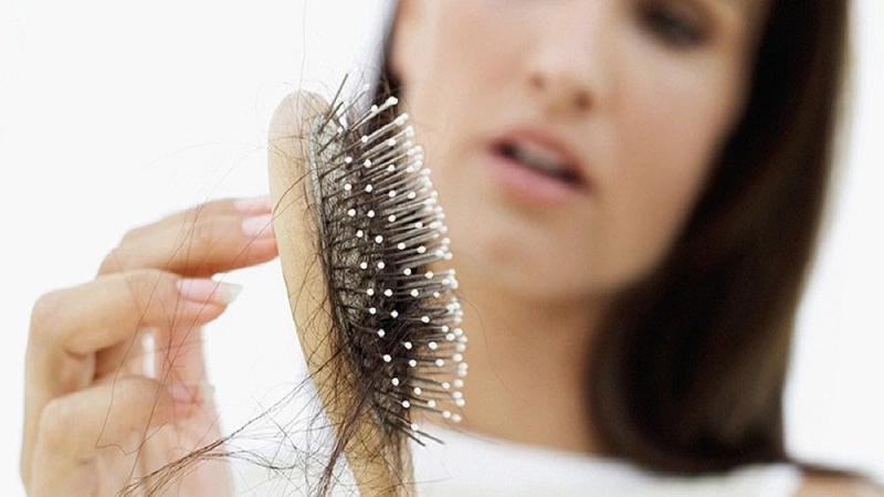 Bị hói đầu có nên đi cấy tóc  Tuổi Trẻ Online