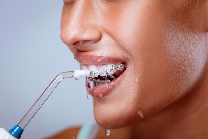 Dùng máy tăm nước hay chỉ nha khoa là phụ thuộc vào bạn