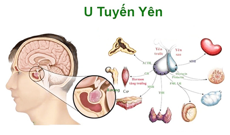 Cấu trúc tuyến yên