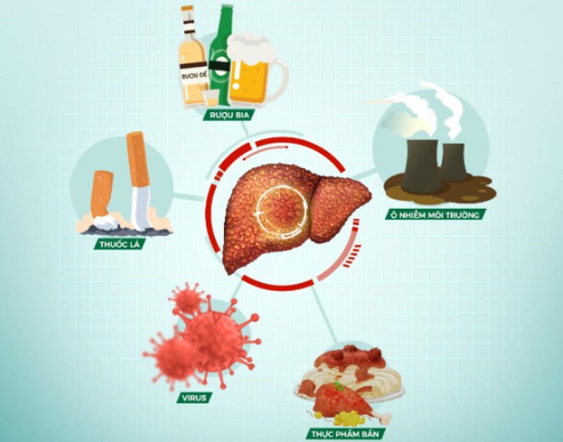 Chẩn đoán xơ gan và cách điều trị hiệu quả.2