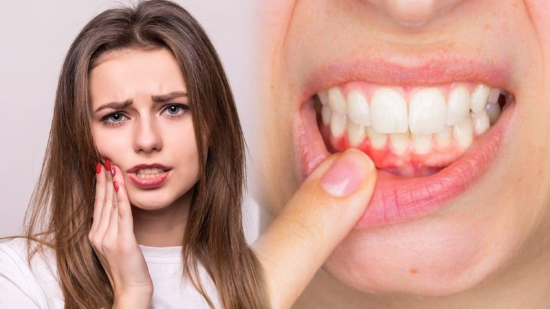 Chảy máu chân răng thường xuyên có nguy hiểm không?