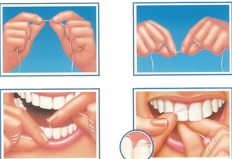 Cha mẹ hướng dẫn trẻ em dùng chỉ nha khoa