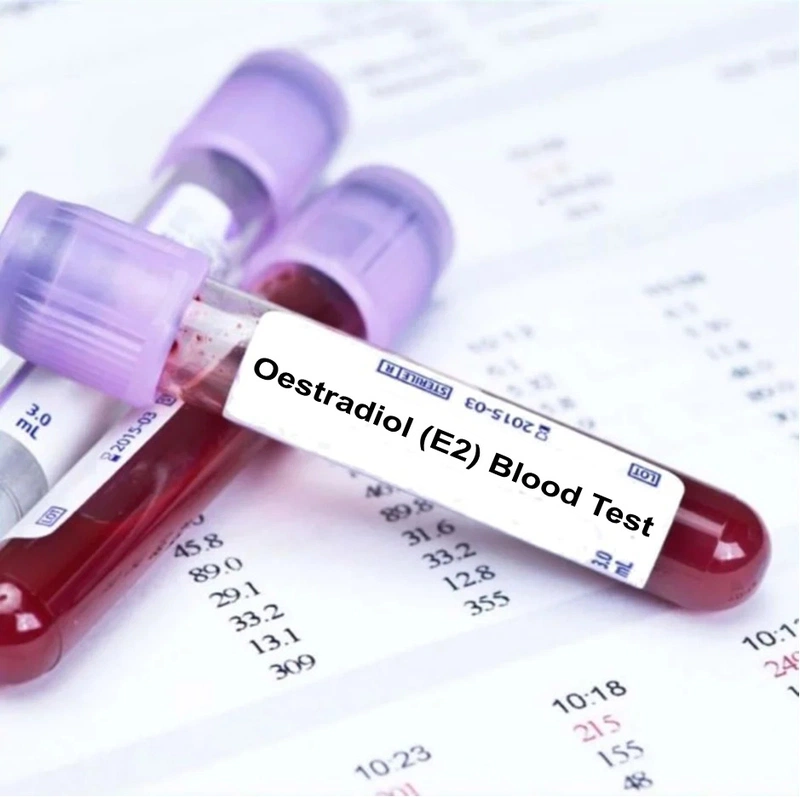 Chỉ số Estradiol cao có ảnh hưởng gì không 3