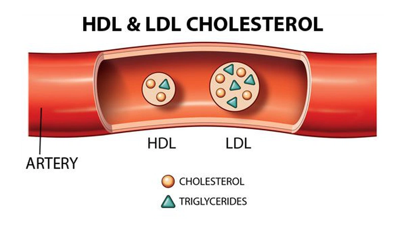 Cholesterol bao gồm cholesterol LDL và cholesterol HDL