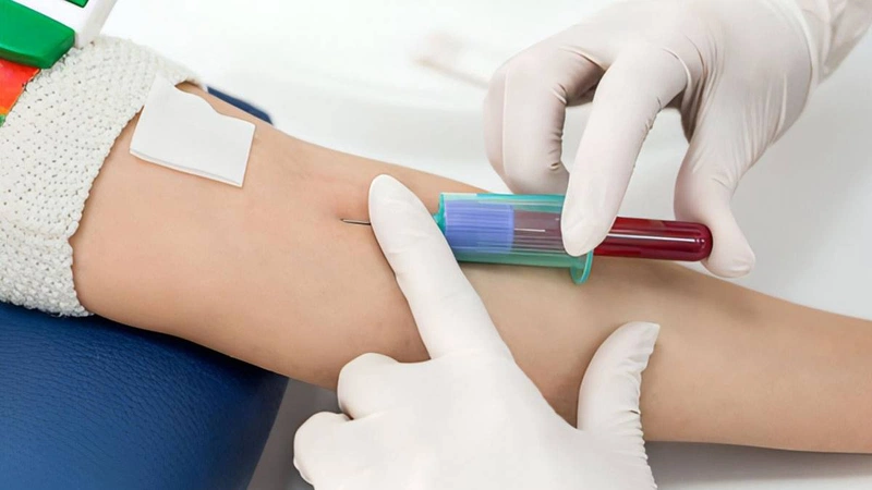 Chỉ cố công thức huyết thông thường và những cảnh báo khi xét nghiệm huyết 2 5