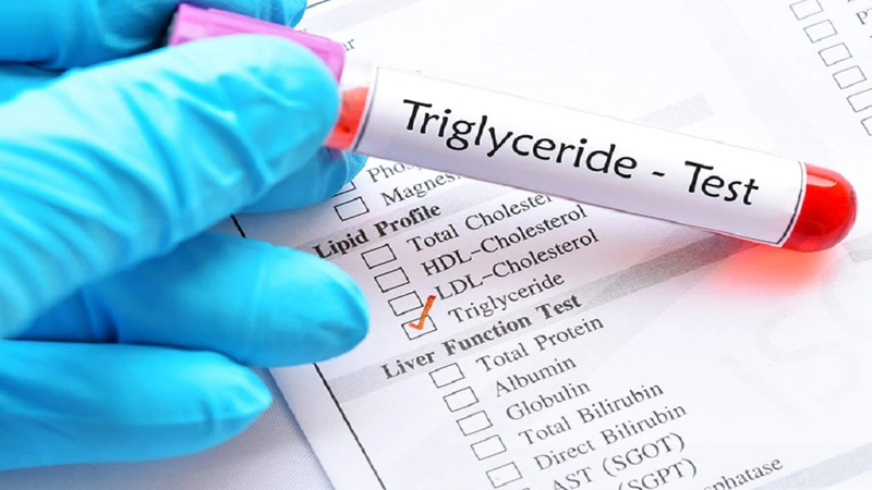 Người bệnh có thể xác định chỉ số triglycerid máu trong cơ thể thông qua xét nghiệm máu