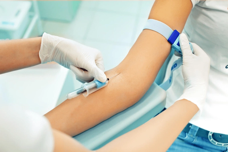 Chỉ số WBC trong xét nghiệm máu là gì?2