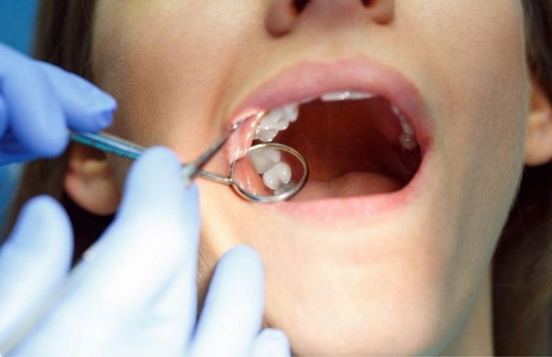 Nhổ răng thừa không gây đau nhiều do bệnh nhân sẽ được tiêm thuốc tê