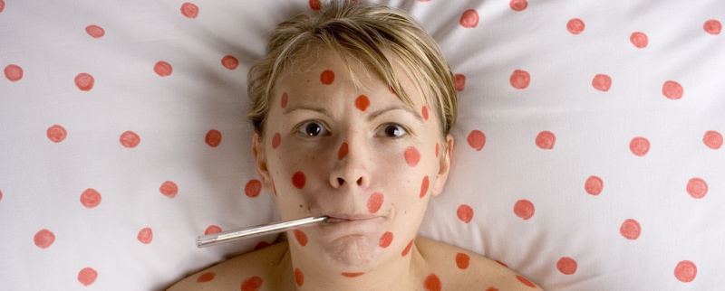 Chích ngừa thủy đậu ở đâu và khi nào để an toàn?