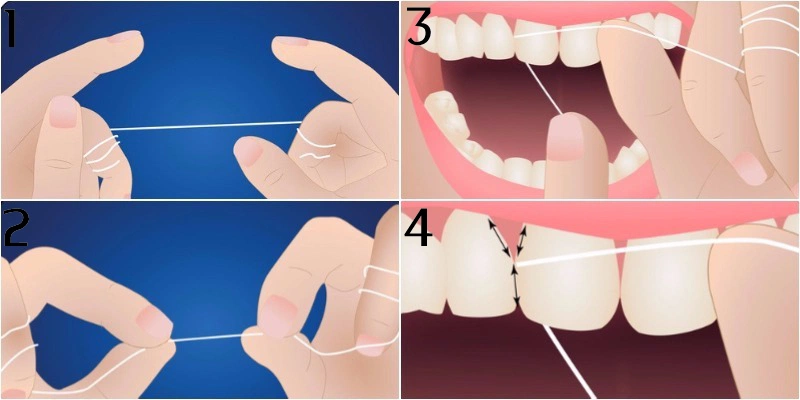 Hướng dẫn cách dùng chỉ nha khoa cho bé