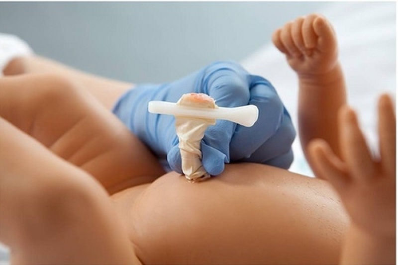 Chủ động dự phòng uốn ván rốn ở trẻ sơ sinh 3