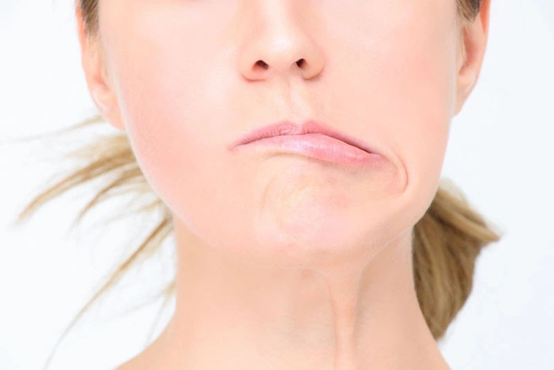 Chữa bệnh liệt mặt lâu năm có hy vọng không?