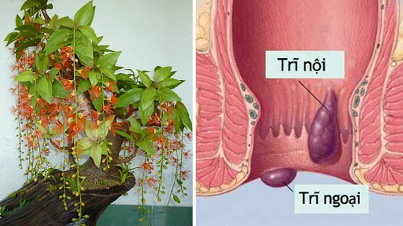 Phương pháp chữa bệnh trĩ bằng cây lộc vừng an toàn và hiệu quả 1