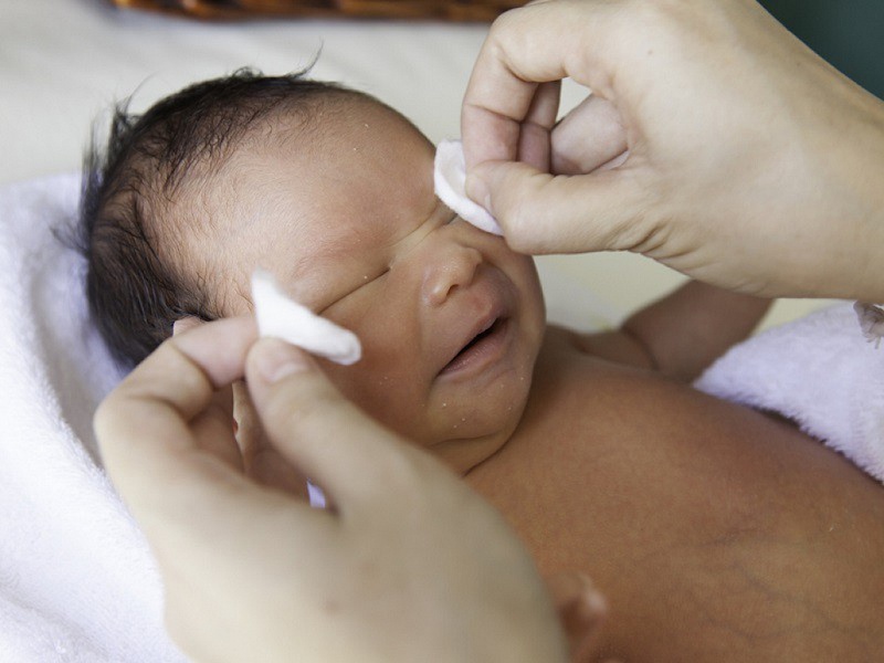 Có nên chữa đau mắt cho trẻ sơ sinh bằng sữa mẹ không 1