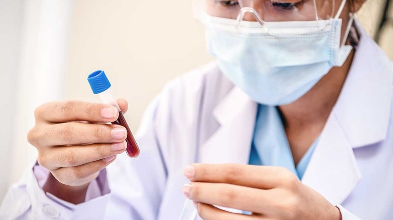 Chuẩn đoán gout – Biện pháp điều trị 1