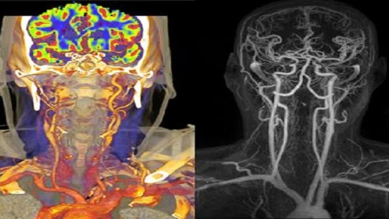 Chụp CT và MRI khác nhau như thế nào? 3