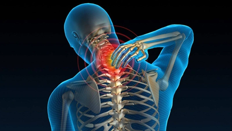 Chụp MRI cột sống cổ là gì và một số lưu ý 2