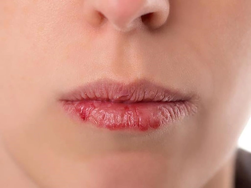 Có bầu xăm môi được không Có ảnh hưởng thai nhi không