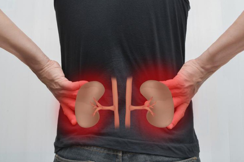 Có hay không tình trạng sỏi thận dẫn đến đau lưng 1