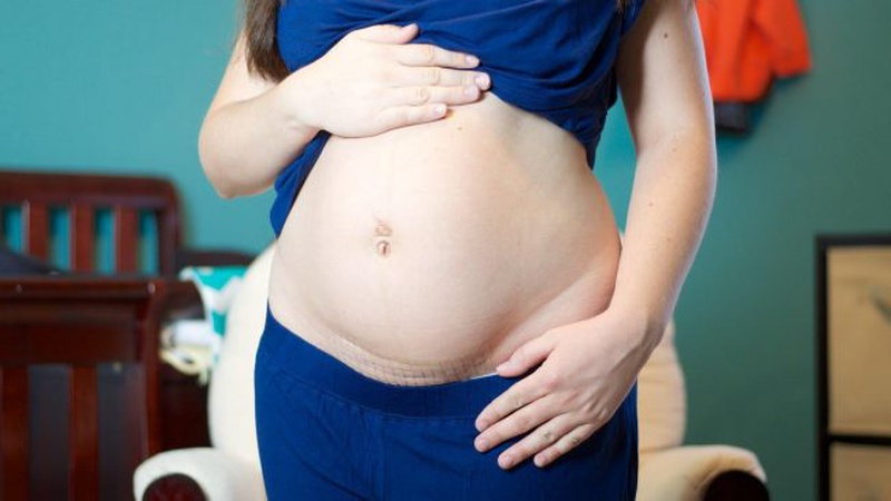 Chăm sóc sức khỏe mẹ bầu sau sinh mổ và khi mang thai trở lại