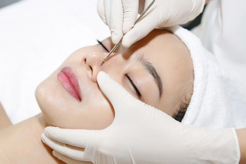 Có nên đi nặn mụn ở spa không? Ưu và nhược điểm khi đi lấy nhân mụn tại spa 3