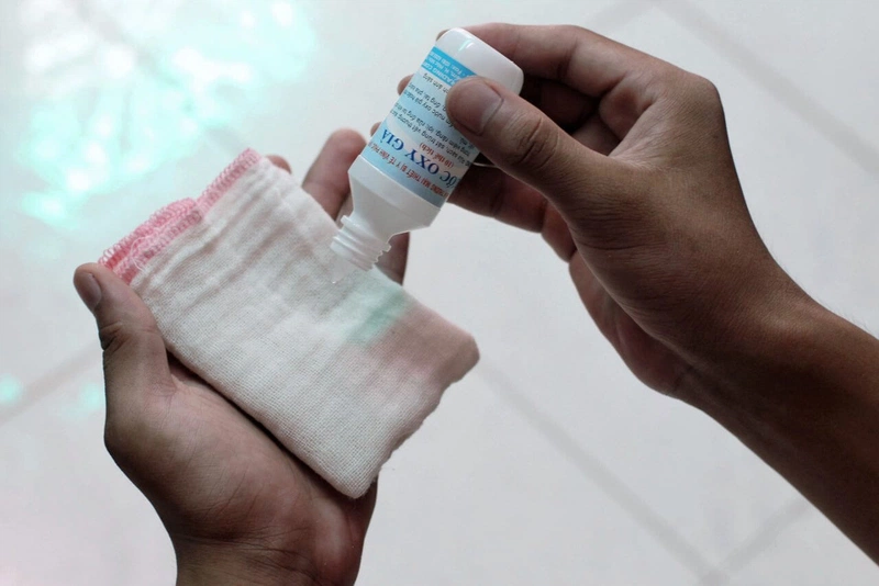 Có nên rửa tai bằng oxy già hay không 1