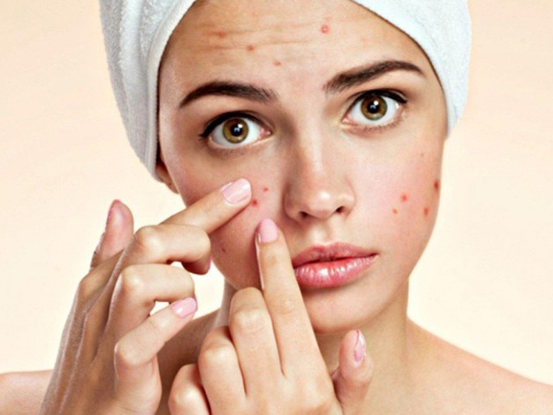 Có phải bệnh thủy đậu dẫn đến vô sinh 3