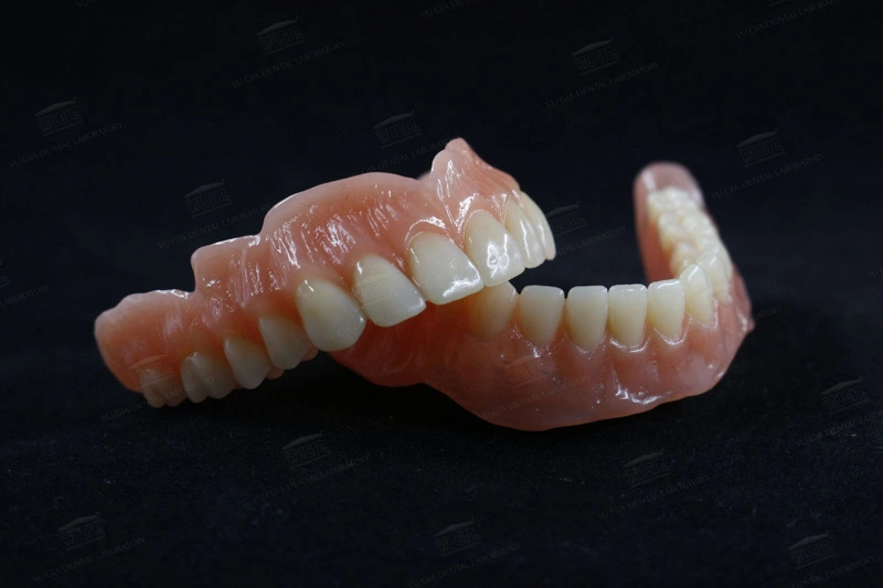 Có răng giả có niềng răng được không?2