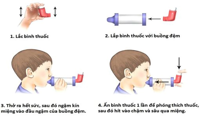 Sơ cứu hen phế quản 3